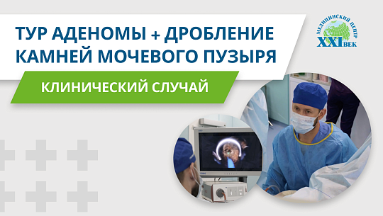 ТУР аденомы предстательной железы + удаление камней мочевого пузыря